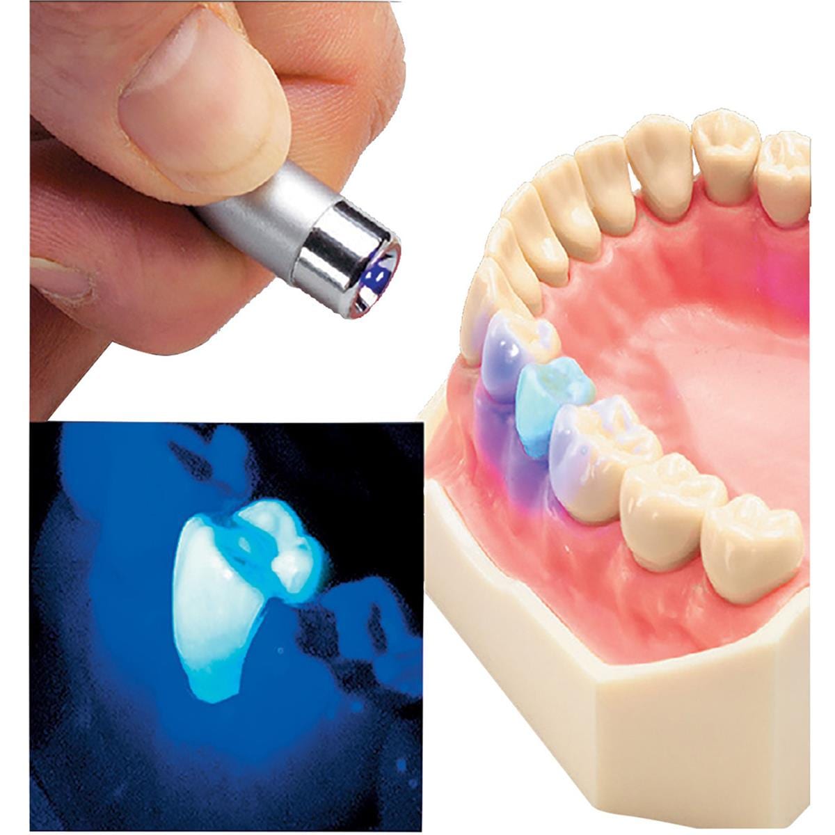 Model Fluorescent Tooth No 26